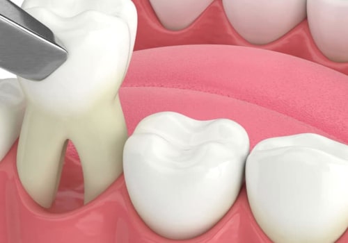 What to Expect After a Dental Procedure