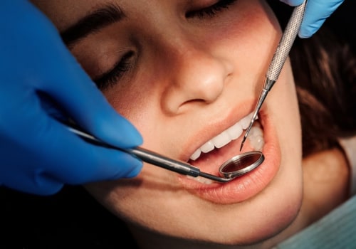 What is a Type 3 Dental Exam?